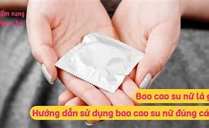 Bộ Đội Bây Giờ Balo Toàn Bao Cao Su